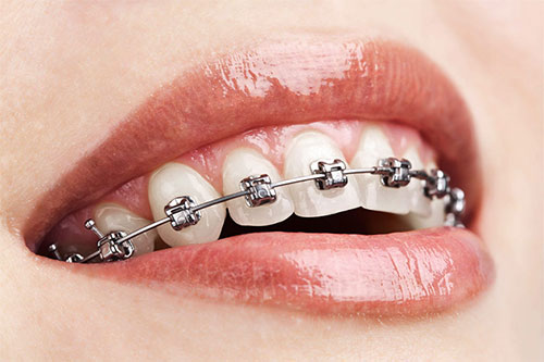 orthodontics dentistry